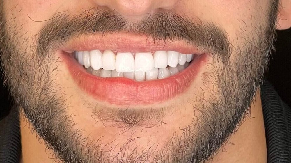 Sorriso de Thiago depois do tratamento na Clínica CZN